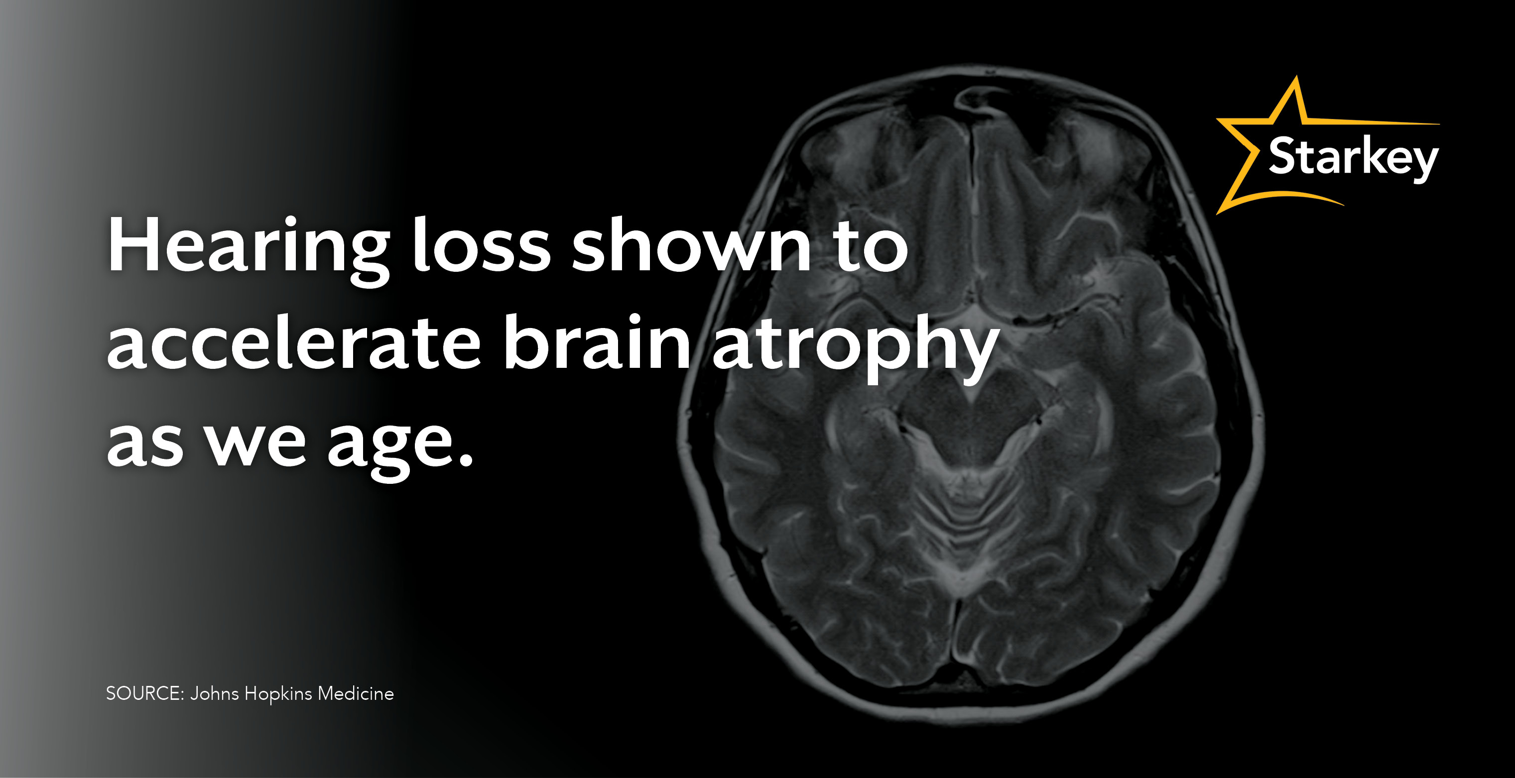 Image of brain next to quote that reads "Hearing loss shown to accelerate brain atrophy as we age."